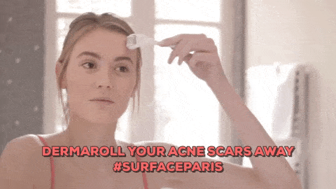 Comment atténuer vos cicatrices d'acné - Surface Paris